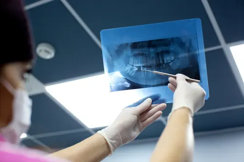 Dental tomografi nedir?