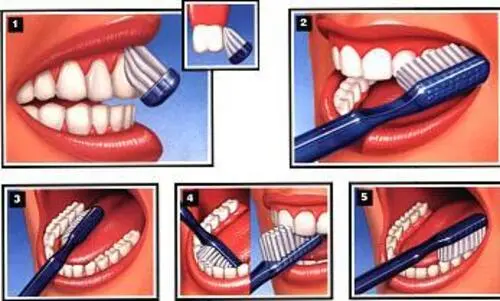 Diş nasıl fırçalanmalıdır?